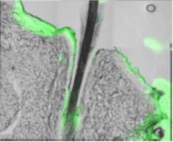 Particle-mediated transport of dissolved active agents into hair follicles
