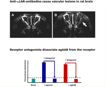 Targeting of Autoantibodies to the alpha1-adrenergic receptor and the beta2-adrenergic receptor in Alzheimer’s and vascular dementia