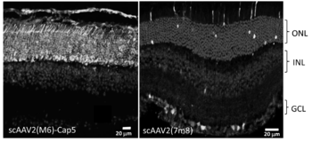 AAV Vector Variants for Ocular Gene Delivery