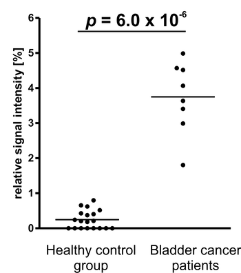 Novel Diagnostic Marker For Early Detection Of Bladder Cancer