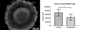 Automated production of cardiac organoids