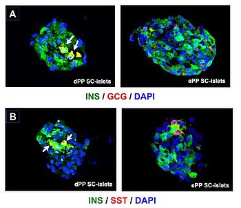 Expansion of pancreatic progenitors derived from human pluripotent stem cells und GMP-compliant conditions