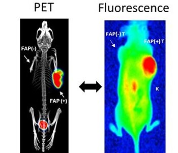 FAP-targeted dual imaging for guided cancer surgery