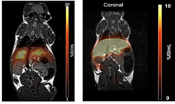Liver Function imaging of the functional hepatic reserve