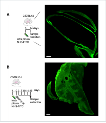 Novel therapy approach for treatment of lung fibrosis