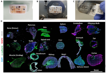 Efficient multiplex cryo-embedding method for cost-efficient, high-throughput tissue analysis